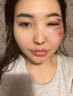 Нападение в Атырау, Куралай Болатову вывезли на кладбище